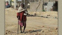 Una mujer enferma de lepra en la India