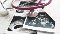 Une image des photos d'une échographie de 4 semaines de grossesse et de 20 semaines. 