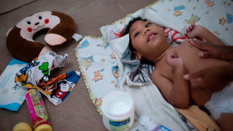 Brazílsky dvojročný chlapec Matheos narodený matke infikovanej vírusom Zika (foto z novembra 2018)