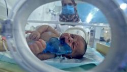 Un neonato in una incubatrice