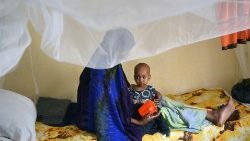 ソマリアの病院で栄養管理を受ける幼児　