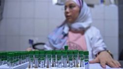 Beim Testen von Blutproben auf Cholera: Aleppo am 11. September