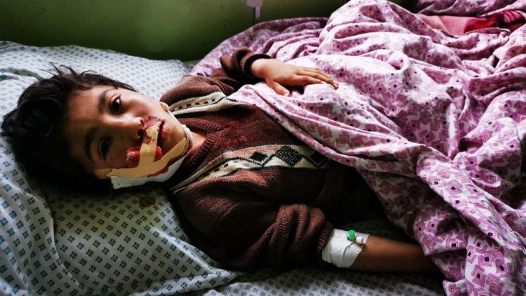 अफगानिस्तान स्कूल हमले में घायल बालक