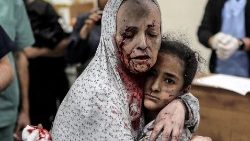 Zraněná palestinská žena pokrytá prachem a krví objímá zraněnou dívku po izraelském bombardování Chán Júnisu na jihu pásma Gazy