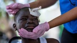 Menino ferido após o terremoto de magnitude 7,2 no sábado chora enquanto é tratado no Hospital Ofatma, em Les Cayes, Haiti, em 18 de agosto de 2021. REUTERS / Ricardo Arduengo