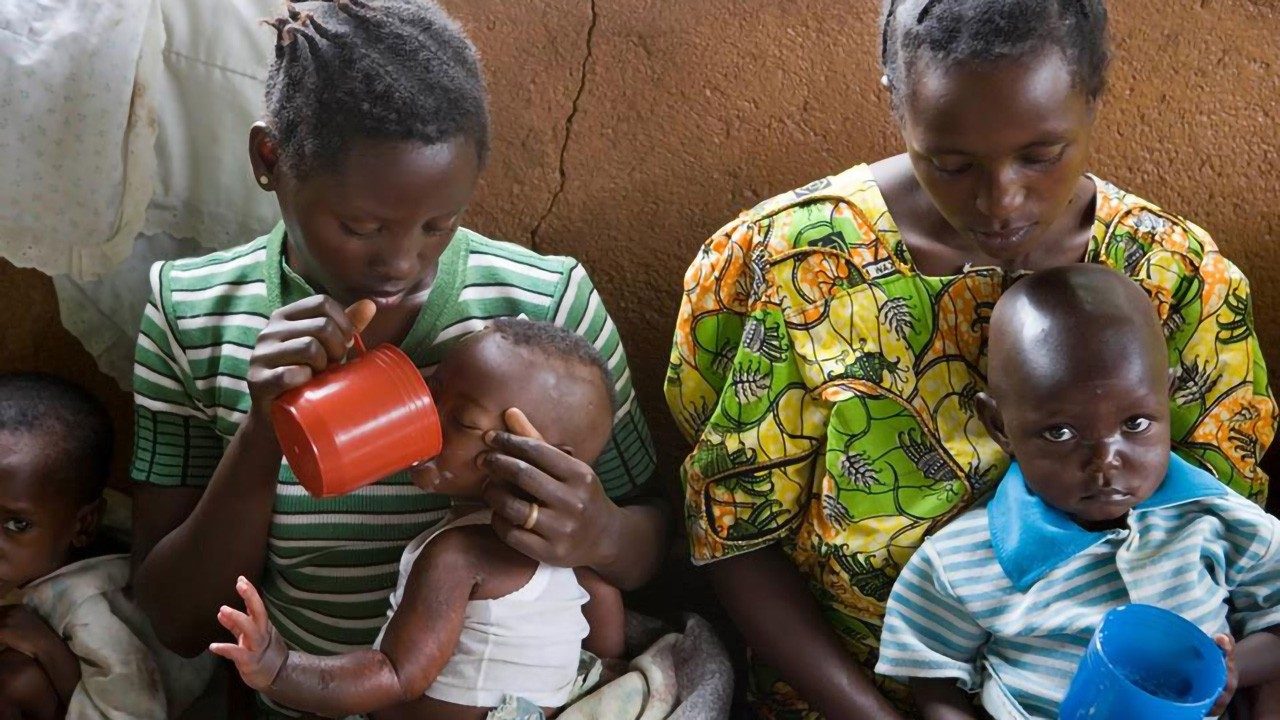 Covid19: 6,7 millones más de menores de 5 años con desnutrición aguda -  Vatican News