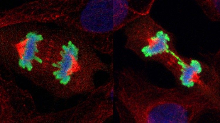 Snímka z výskumu: vľavo zdravá deliaca sa bunka, vpravo chorá deliaca sa bunka