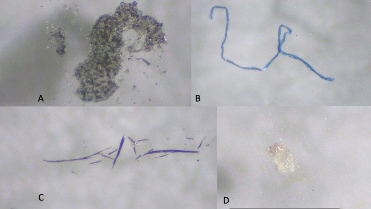 Types of atmospheric microplastics found in Metro Manila air categorized based on shape. From upper left to lower right: granules, fiber, fragment, and film. Photo from Romarate et. al.