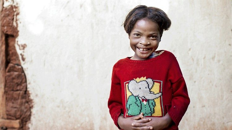 La piccola Clara, una delle pazienti che ha ritrovato il sorriso grazie all'azione di Fondazione Operation Smile Italia 